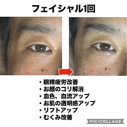 ビフォーアフター