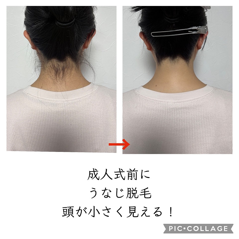 うなじ脱毛、シェービング